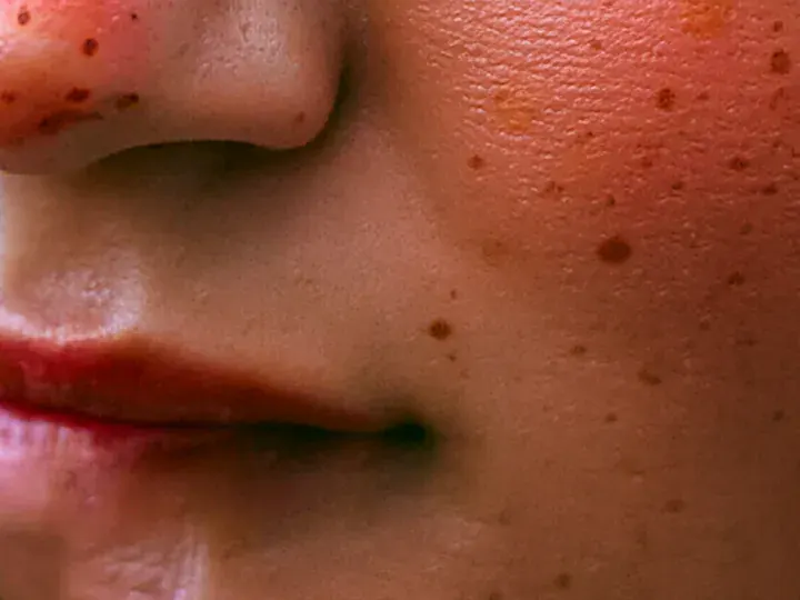 MegaPotato: a 140 × 105 px detail of the Portrait photo